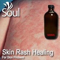 Essential Oil Skin Rash Healing - 10ml - Click Image to Close